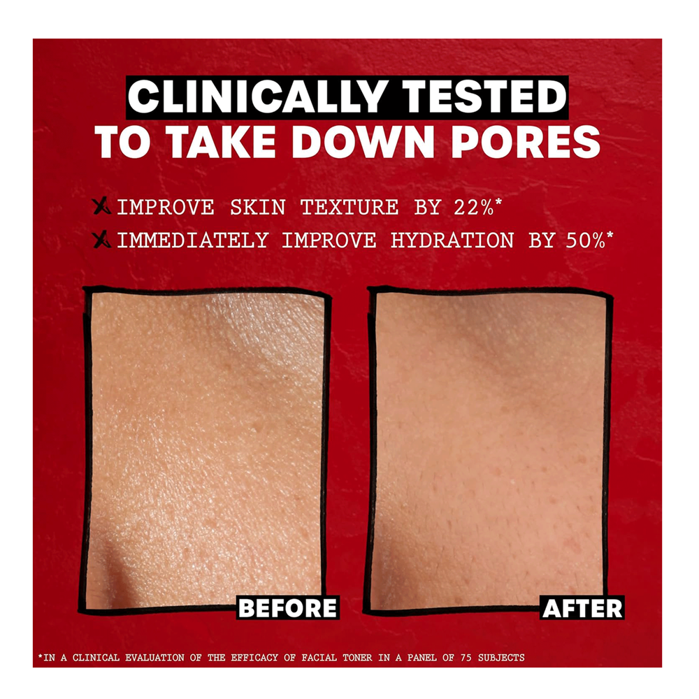 Thayers Alcohol-Free Witch Hazel Toner - Cucumber